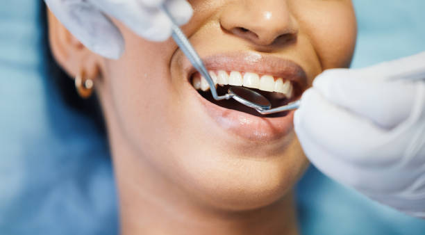 Best Chipped Tooth Repair Near Me  in Breinigsville, PA